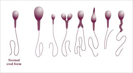 Sperm